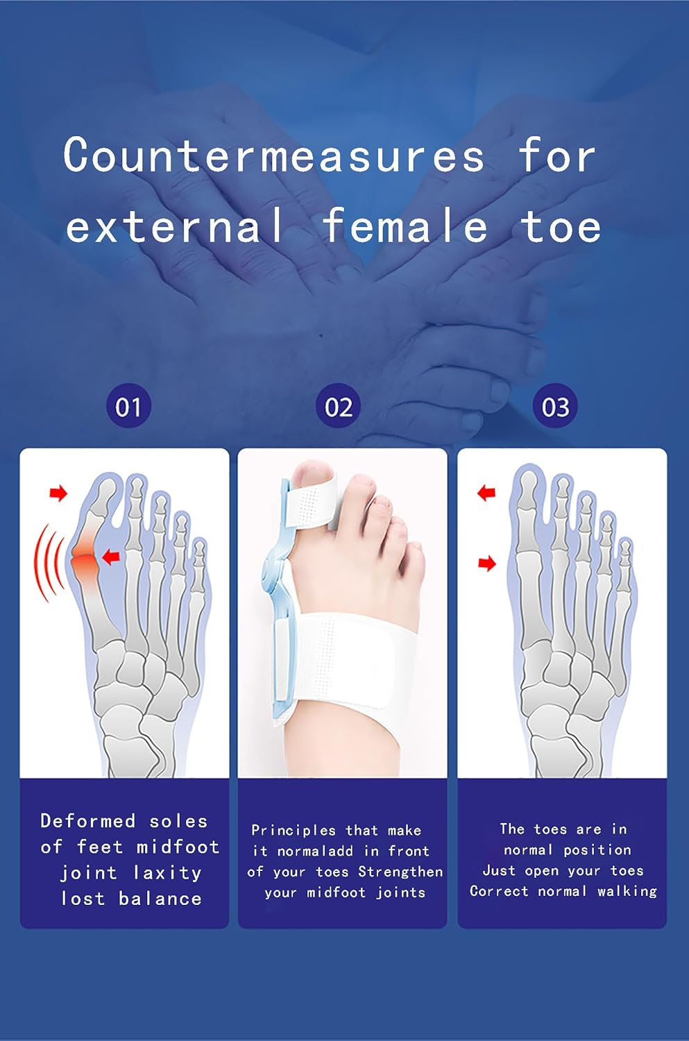 Correcteur d’Orteil – Ajustement Doux et Correction Progressive