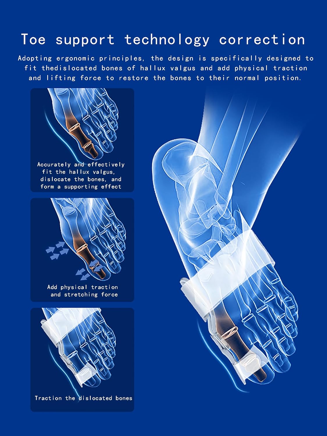 Correcteur d’Orteil – Ajustement Doux et Correction Progressive